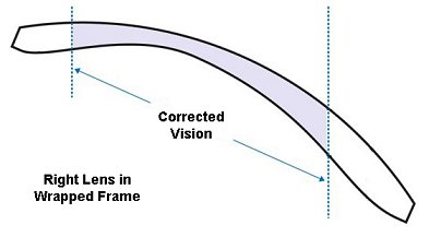 Lenticular Free Form Prescription Lens